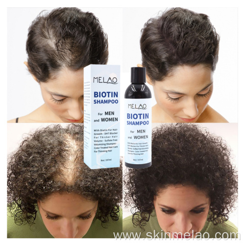 Biotin Hair Shampoo For Men And Women
